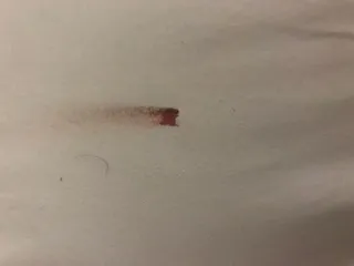 Bed bug stains on mattress sheets